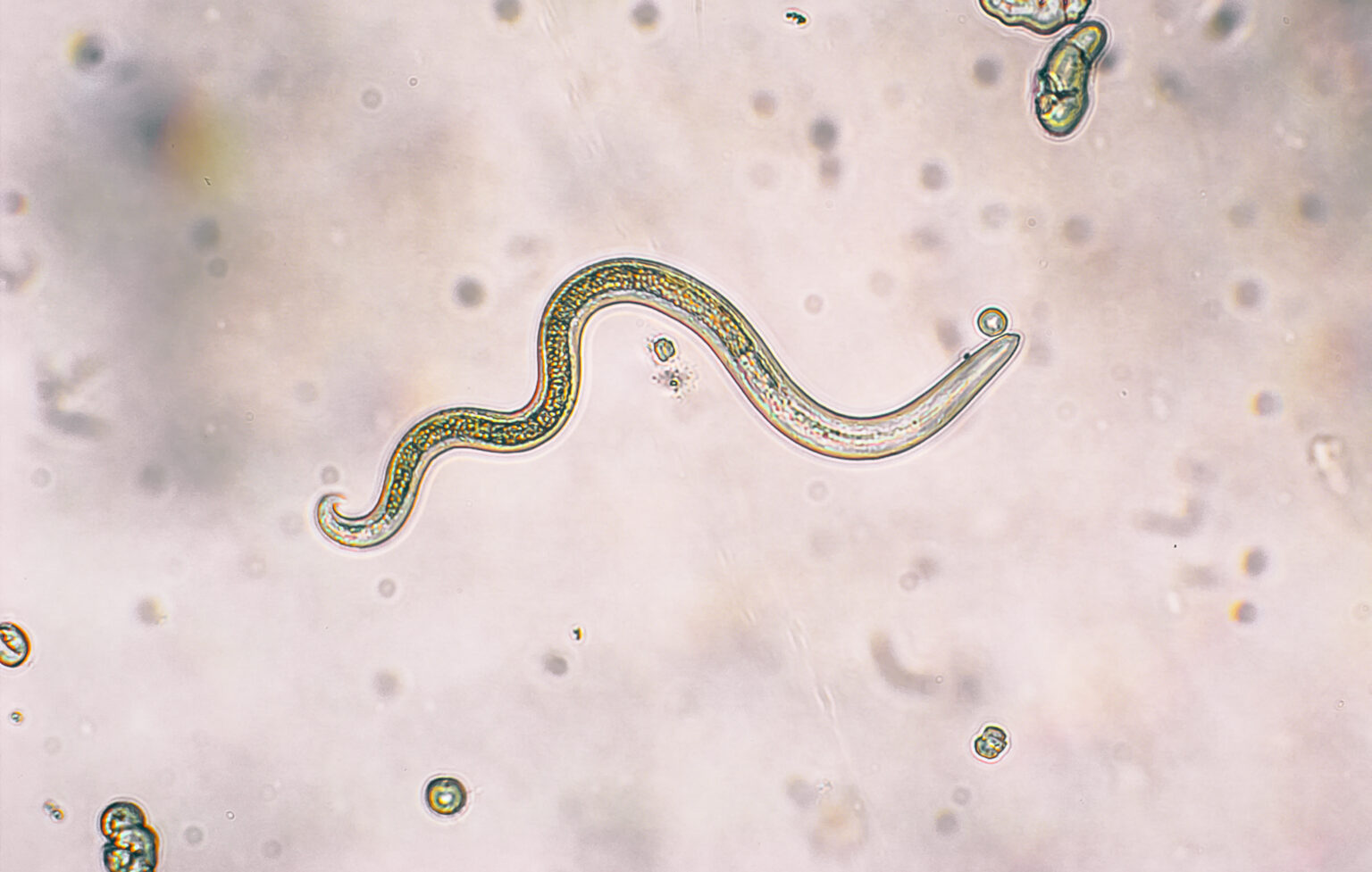 Why Would God Create a World with Parasites?