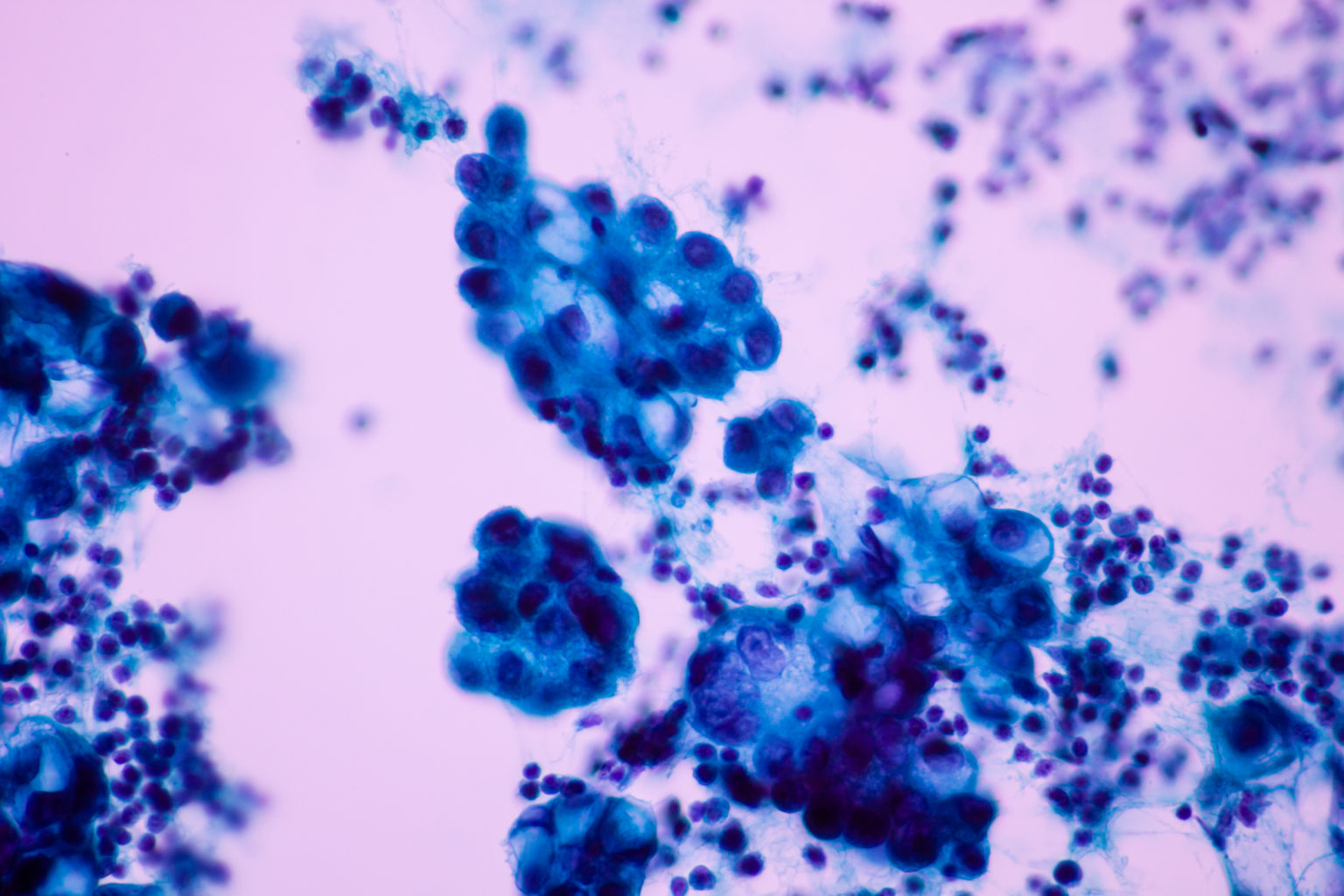 Endogenous Retroviruses Help Fight Tumors