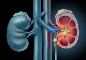 blog__inline-pseudogene-discovery-pains-1 blog__inline-pseudogene-discovery-pains-1