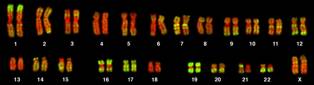 Chromosomes stained for Alu elements Chromosomes stained for Alu elements